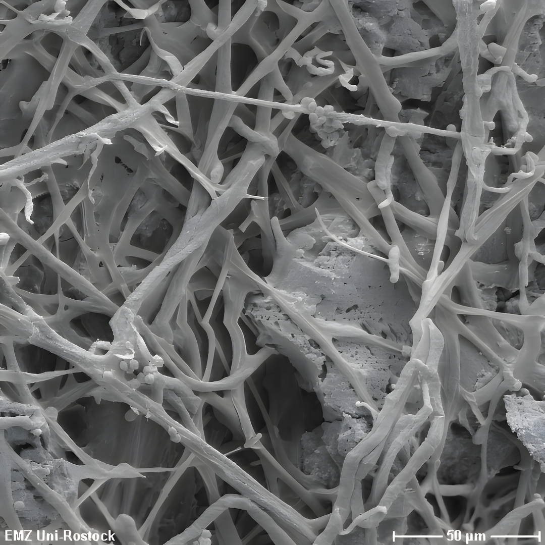 Pilzhyphen verdauen D�nger. Die Aufnahme ist unter einem Elektronenmikroskop entstanden.