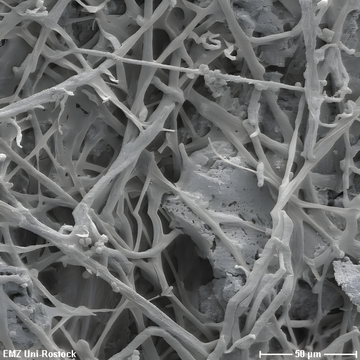 Pilzhyphen verdauen D�nger. Die Aufnahme ist unter einem Elektronenmikroskop entstanden.
