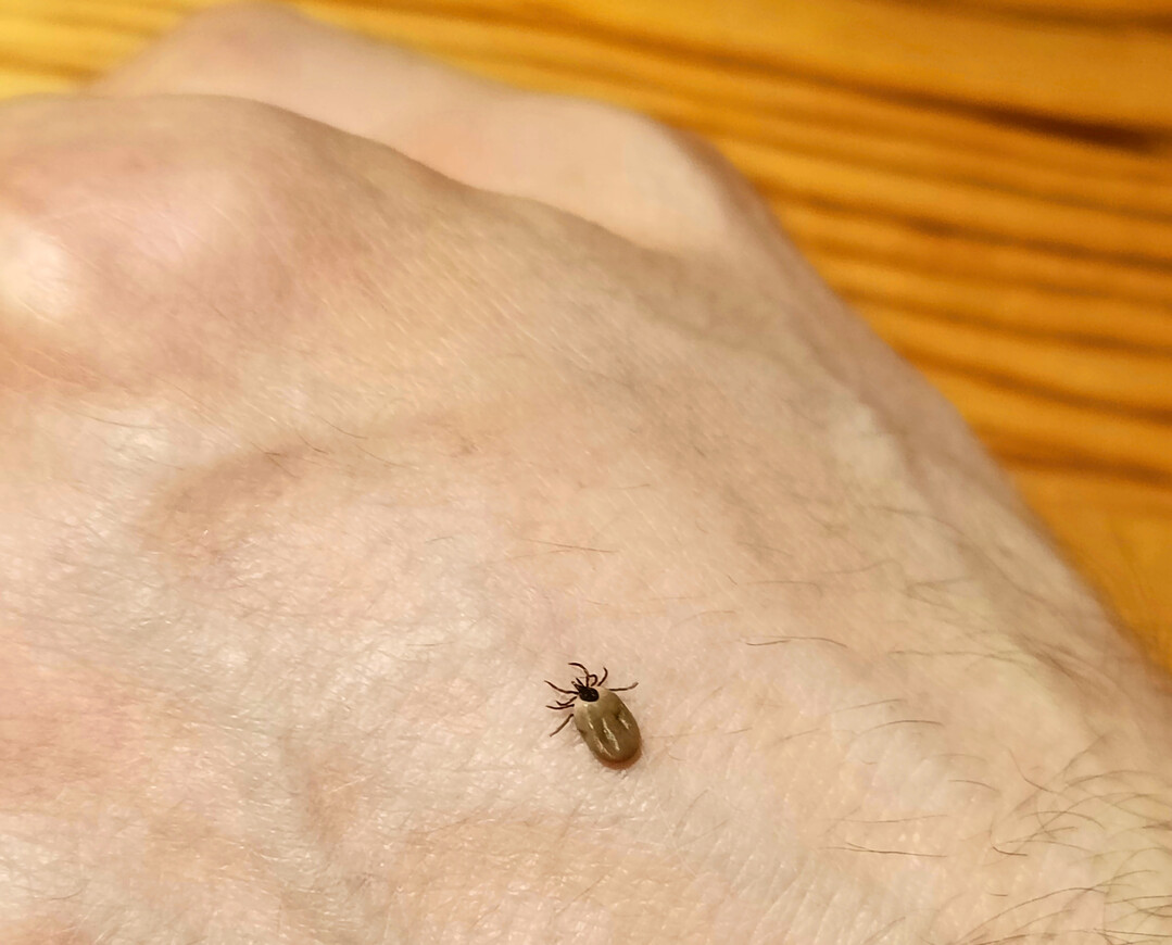 Zecke auf einer Hand.