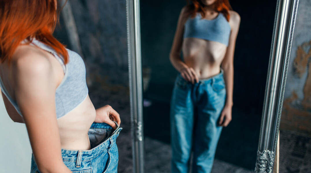 Magersucht: Trotz eines erheblichen Energiemangels bleibt das Essverlangen aus.