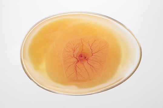 Der Bundestag hat einer Lockerung der Vorgaben zur Tötung von Hühnerembryos zugestimmt.