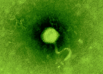 Elektronenmikroskopische Aufnahme eines Bakteriophagen.